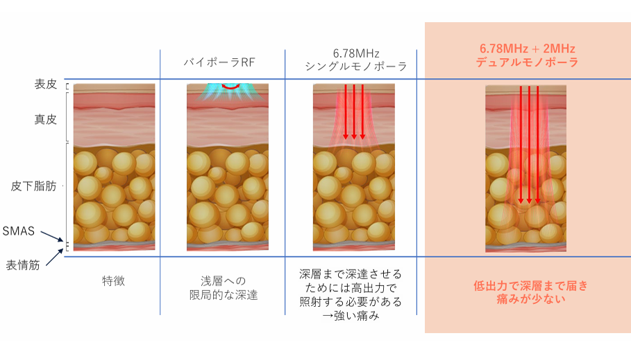 世界初のデュアル周波数